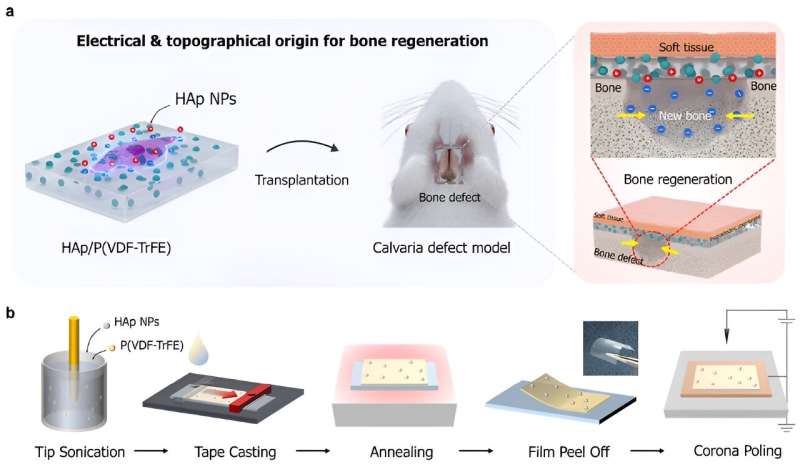 Researchers develop a novel 'bone bandage' material for cracked bones